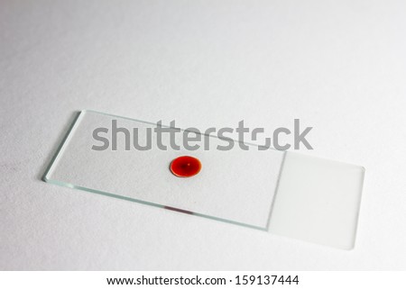 Laboratory glass slide with red fluid on/laboratory test/studio shoot