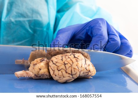 Slicing a cow brain with a blade in anatomy class down the mid section to obtain a longitudinal cross-section to study the structure of the tissue