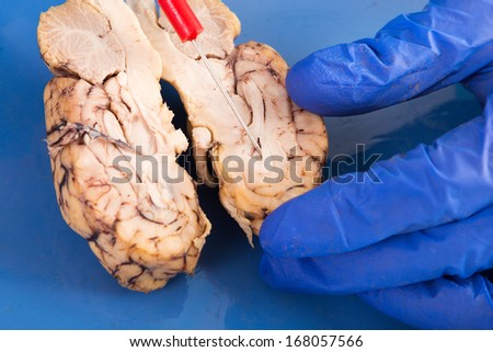 Cross-section of a cow brain showing the convoluted tissue with a probe pointing to the frontal lobe