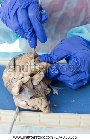 Medical student studying the structure of a preserved sheep heart dissecting it with a scalpel cutting into the muscle of the wall of a ventricle, closeup view of the hands