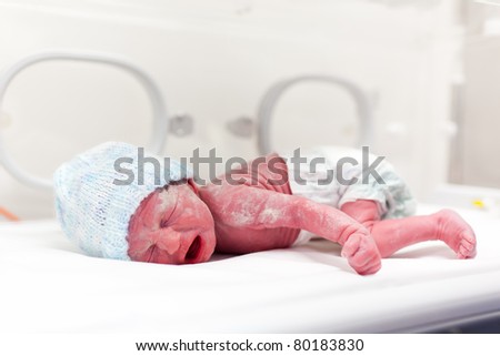Newborn baby boy covered in vernix in incubator