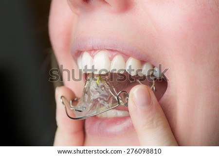 adjust a dental brace in a mouth