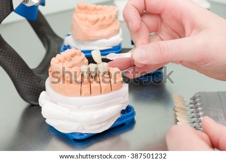 Check veneer of dental implant in a dental laboratory