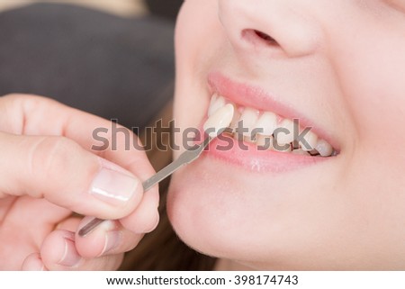 Check veneer of tooth crown in a dental laboratory