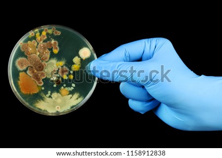 Gloved hand holding petri dish growing bacteria
