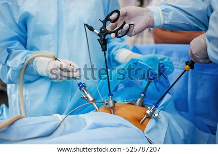 Operation using laparoscopic equipment