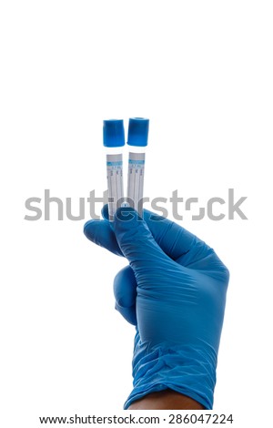 Hand with a test tube on a white background, coagulation sodium citrate