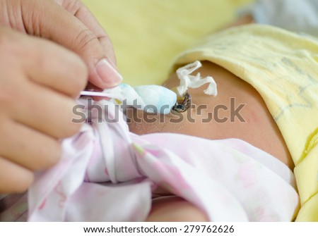Close up cleaning umbilical cord of 4 days after newborn with alcohol