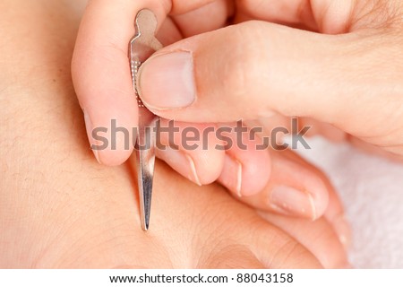 Macro detail of a heragata spear acupuncture tool being used on a foot of a young male patient