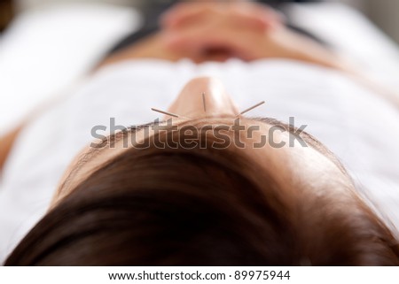 Macro detail of three needles in face of acupuncture patient