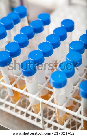 Test tubes with samples in medical laboratory