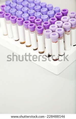 Rows of test tubes in medical laboratory
