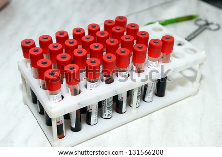 ROSTOV-ON-DON, RUSSIA - MARCH 2: Test tubes for blood donations - The City Blood Service makes a promo action for donorship popularization, March 2, 2013 in Rostov-on-Don, Russia
