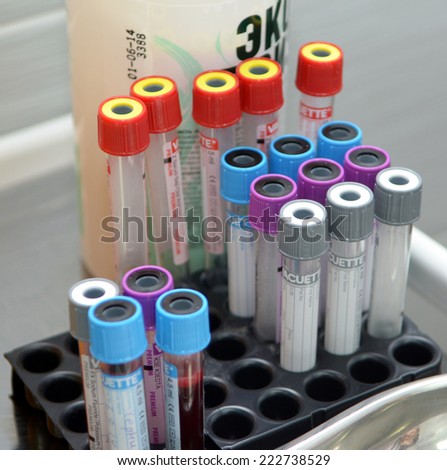 Tubes of blood for medical analysis and empty tubes in a laboratory