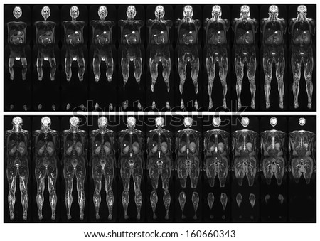 Complete real MRI scan of the human body, from the front and back