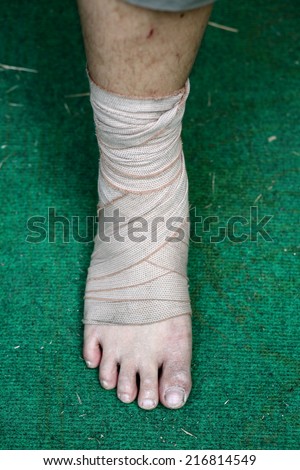 Foot and Ankle injured with bandage on green background
