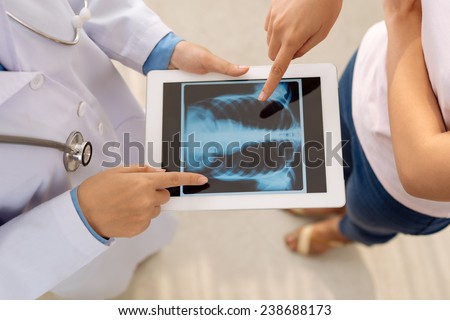 Doctor showing chest x-ray on digital tablet to female patient, view from above