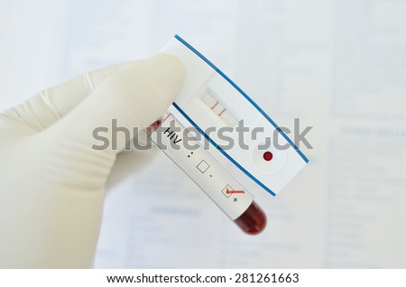 Detection of anti-HIV in blood by using test cassette, the result showed positive (double red line)