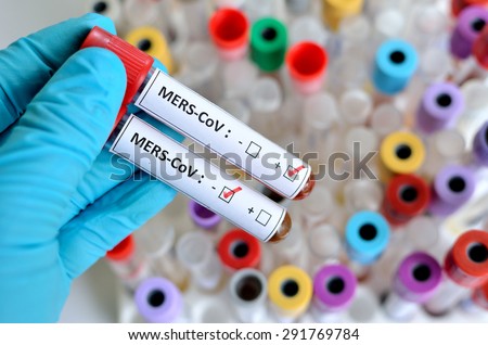 Blood sample with MERS-CoV (Middle East respiratory syndrome coronavirus) positive and negative