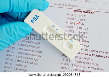 PSA (Prostate-specific antigen) testing by using test cassette, the result showed negative (single red line)