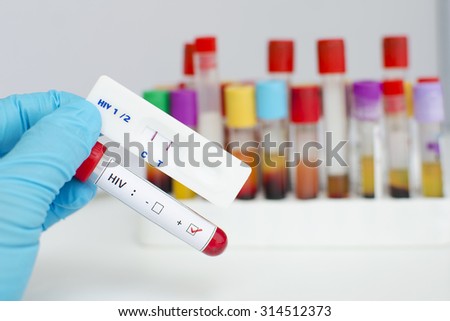 HIV testing by using test cassette, the result showed positive (double red line)