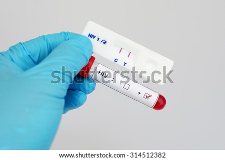 HIV testing by using test cassette, the result showed positive (double red line)