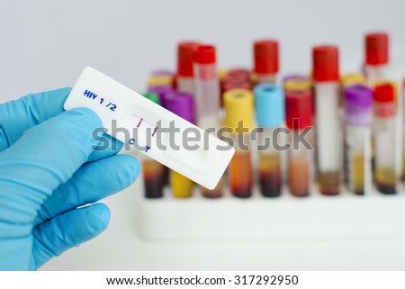 HIV testing positive