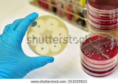 Antimicrobial susceptibility testing in culture plate
