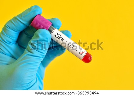 Blood sample positive with Zika virus