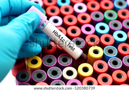 Blood for HbA1c test, diabetes diagnosis