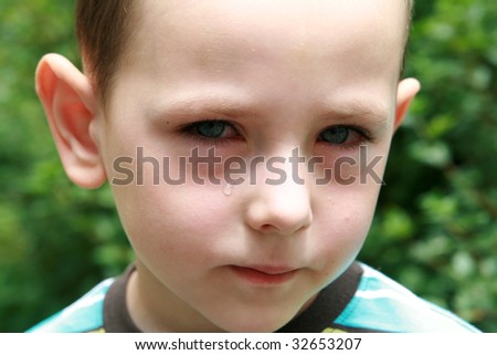 Boy with allergy, conjunctivitis and black rings round his eyes.