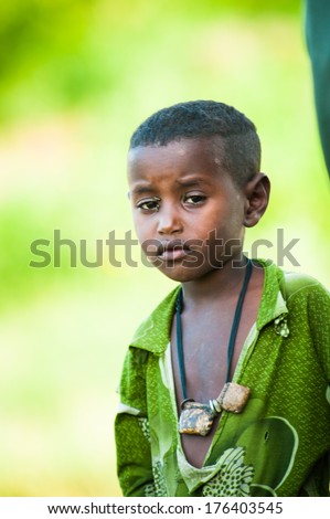 OMO, ETHIOPIA - SEPTEMBER 20, 2011: Unidentified Ethiopian boy with a fly over his head. People in Ethiopia suffer of poverty due to the unstable situation