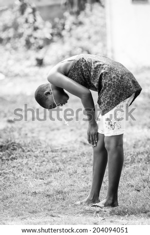 ACCARA, GHANA - MAR 2, 2012: Unidentified Ghanaian girl checks out her knee in the street  in black and white. People of Ghana suffer of poverty due to the unstable economical situation