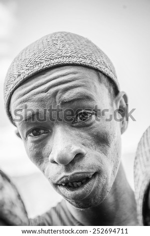 MADAGASCAR - JUNE 30, 2011: Portrait of an unidentified surprised man in Madagascar, June 30, 2011. People of Madagascar suffer of poverty due to the unstable situation.