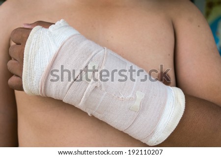 An injured arm wrapped from wrist to elbow.