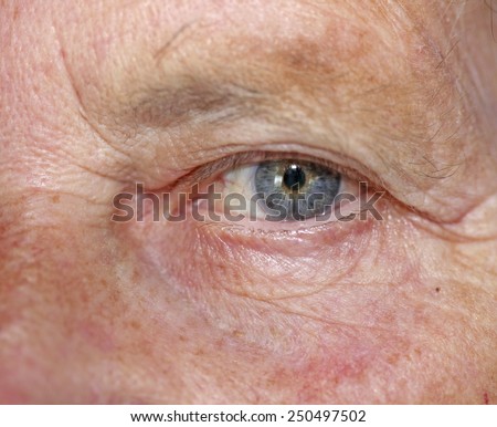 Old women blue eye