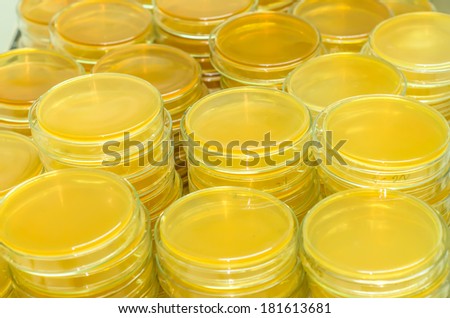 petri dishes with culture medium in the laboratory