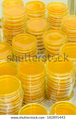 petri dishes with culture medium in the laboratory