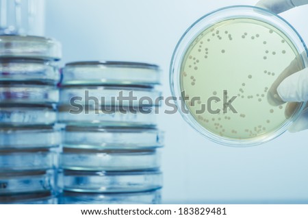 Agar plate full ofmicro bacterias and microorganisms