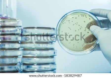 Scientist looking at Petri dish in a laboratory Scientist looking at Petri dish in a laboratory