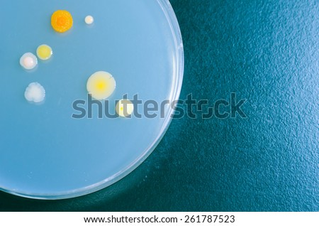Macro mold and bacterial colonies growing on an agar plates.