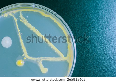 Macro mold and bacterial colonies growing on an agar plates.