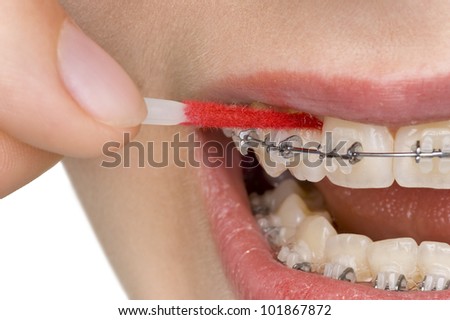 beautiful teeth with perfect oral hygiene