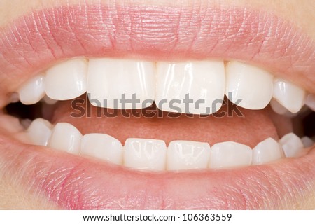perfect teeth with perfect oral hygiene