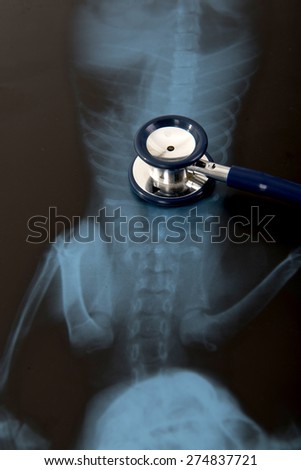 stethoscope and x-ray image of pet