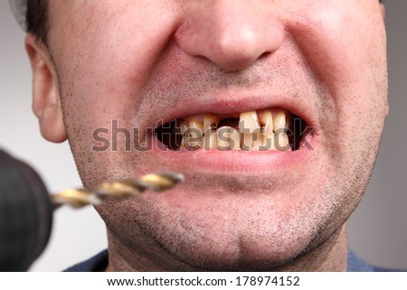 Bad teeth smoker, drill
