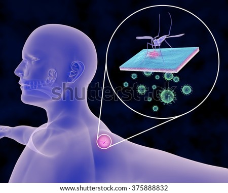An illustration related to Mosquito-Borne Infections such as Malaria, Zika, Yellow Fever, West Nile Virus, Dengue, Chikungunya and host of other diseases. Depicted is a person receiving bite/infection