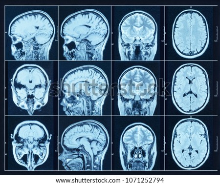 Closeup of a CT scan with brain. Science and education mri background.