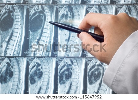 magnetic resonance image (MRI) of the backbone