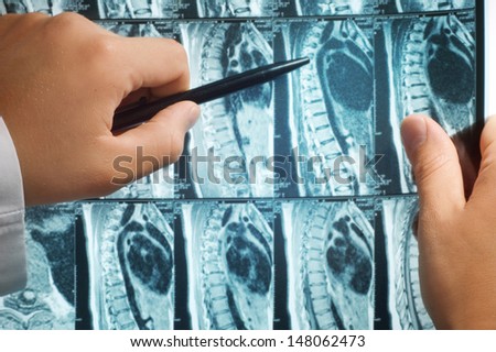 magnetic resonance image (MRI) of the backbone